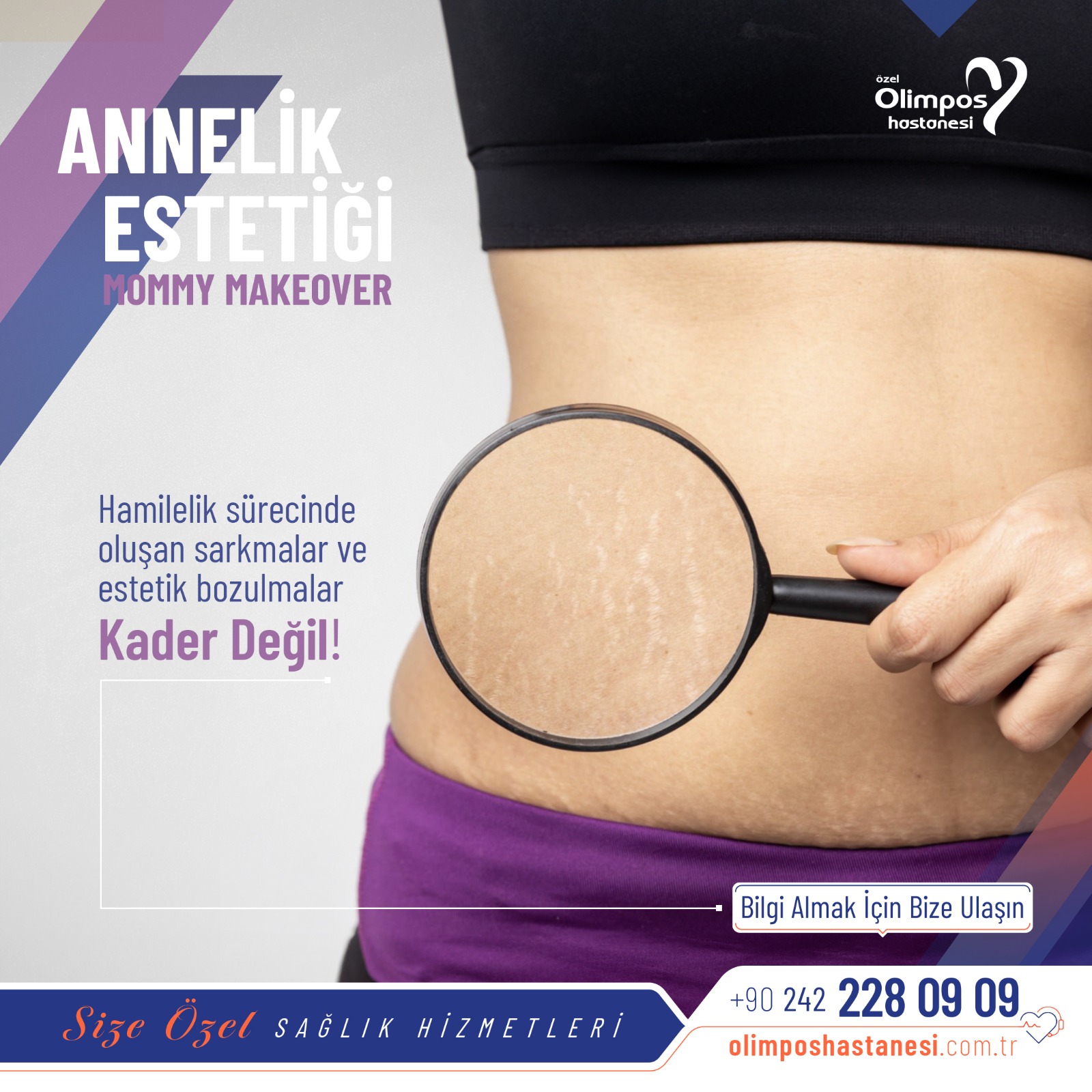 MOMMY MAKEOVER - ANNELİK ESTETİĞİ -de