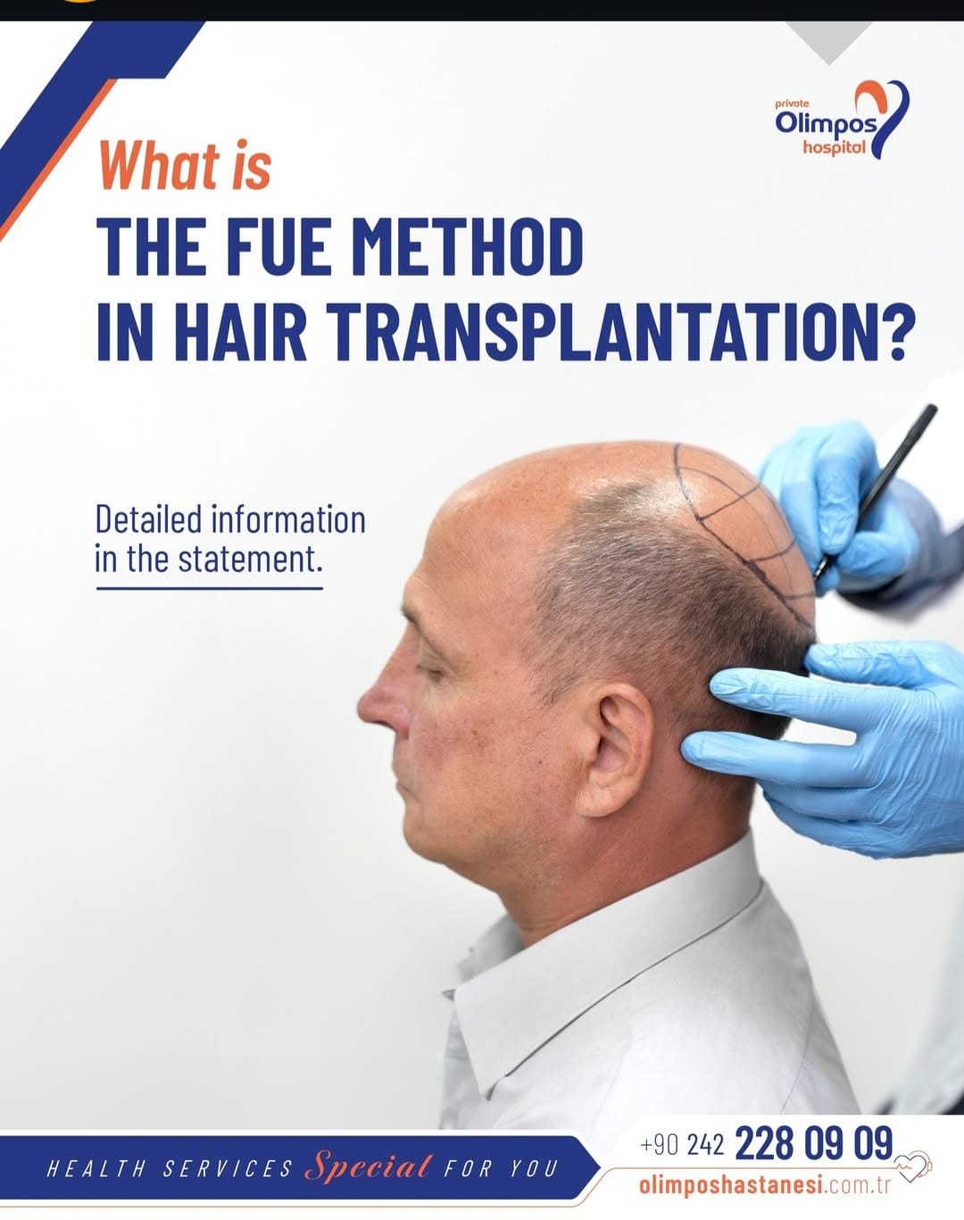 What is the FUE method in hair transplantation? -tr